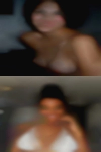 Derma sexy naked girls.